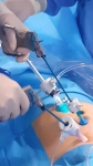 14. LAPAROSCOPIA